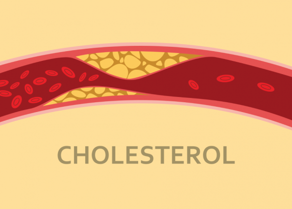 cholesterone cao